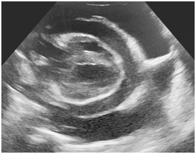 Chronic pericarditis and recurrent pericardial effusion of unknown origin in a kitten: a case report